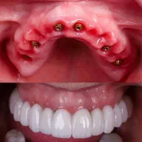 دندانپزشکی تخصصی،ایمپلنت،اوردنچر،ارتودنسی|خدمات آرایشگری و زیبایی|تبریز, |دیوار