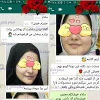 کرم بوتاکس و چاقی صورت لارا|آرایشی، بهداشتی، درمانی|مرودشت, ثبت احوال|دیوار