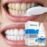 سرم سفیدکننده دندان مدلFlashDent/سفیدکننده برقآسا