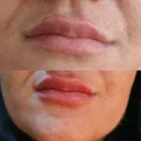 ژل لب 600|خدمات آرایشگری و زیبایی|ماهدشت, |دیوار