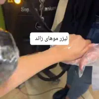 لیزر موهای زائد