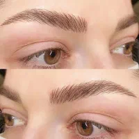 مدل میکروبلیدینگ