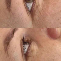 فیشیال و پاکسازی تخصصی پوست|خدمات آرایشگری و زیبایی|قم, قلعه کامکار|دیوار