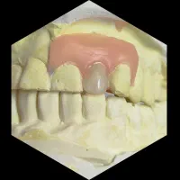 دندان مصنوعی مناسب انواع طرح درمان