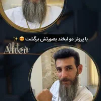 پروتز و ترمیم موی افشان|خدمات آرایشگری و زیبایی|مشهد, کوثر|دیوار