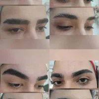 اصلاح صورت