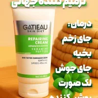 محصولات لاکچری کوین ویتابلا وگاتیو