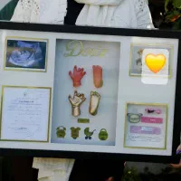 تندیس دست و پا کودک