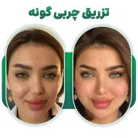 کلینیک زیبایی آفر ویژه برای فصل آینده