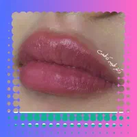 تخفیف ژل لب / مزو / بوتاکس و فیلر|خدمات آرایشگری و زیبایی|مشهد, احمدآباد|دیوار