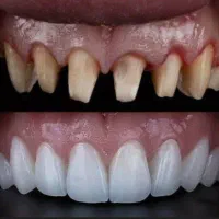 دندان سازی ویتا خدمات و ساخت دندان|پزشکی|بابل, |دیوار