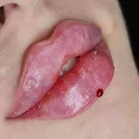 ژل،بوتاکس،فیبروز،رژ دایم،اکستنشن مژه سالن ومنزلتون