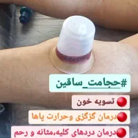 روغن ماساژ،درمان سیاتیک، دیسک، قلنج ،طب سوزنی|خدمات آرایشگری و زیبایی|تبریز, |دیوار