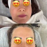 فیشال رایگان|خدمات آرایشگری و زیبایی|رشت, معلم|دیوار