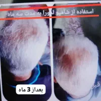بهترین محصول برای ریزش مو و برای رویش مجدد بشرط|آرایشی، بهداشتی، درمانی|اهواز, شریعتی جنوبی|دیوار