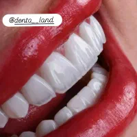 ارتودنسی .کامپوزیت .دندان مصنوعی .بیلیچینگ