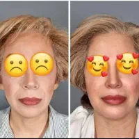 پکیج  چاقی صورت و جوانسازی|خوردنی و آشامیدنی|اهواز, طالقانی|دیوار