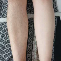 اپیلاسیون تخصصی بانوان