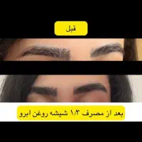 معجزه رشد مو و ابرو مژه واقعی واقعی