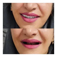 دندانسازی سبک جدید /دندان مصنوعی/دندان سازی