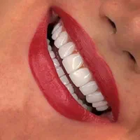 خدمات دندانپزشکی/ایمپلنت/لمینیت و کامپوزیت/اقساطی|خدمات آرایشگری و زیبایی|تهران, ستارخان|دیوار