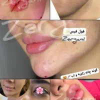 آف تمامی خدمات ارایشی