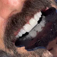 *جشنواره ویژه تابستانه*