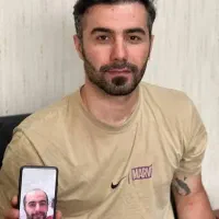 کاشت مو بصورت  اقساطی با تیم مجرب شیرازی و تبریزی