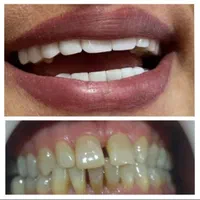 ارائه خدمات زیبایی و درمانی دندانپزشکی|خدمات آرایشگری و زیبایی|کرمانشاه, |دیوار