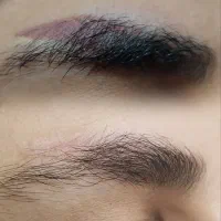 ریمو ابرو شید لب چالوس رادیودریا