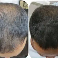 مرکزلاغری‌‌۴دستگا‌ه/prp/لیزرمو/حجم‌سینه‌باسن/هایفو|خدمات آرایشگری و زیبایی|تهران, صادقیه|دیوار
