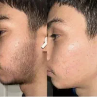 کف دستات هم پشم رشد می‌کنه