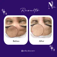 فیشال و پاکسازی پوست|خدمات آرایشگری و زیبایی|اهواز, سپیدار|دیوار