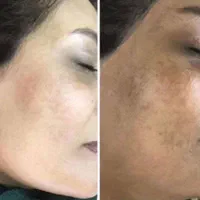 گیاهی روشن کننده ضدلک ۳ روز|خدمات آرایشگری و زیبایی|ایرانشهر, |دیوار