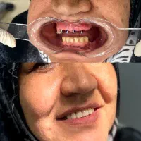 اقساط استثنایی دندانپزشکی همه امور دندان پزشکی|خدمات آرایشگری و زیبایی|اصفهان, دشتستان|دیوار
