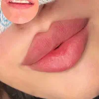 تزریق ژل بوتاکس فیلر لیزرجوانساز مزو مطب زیبایی|خدمات آرایشگری و زیبایی|تبریز, |دیوار