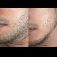 معجون سبز طبیعت قطره گیاهی ضخیم‌کننده ریش