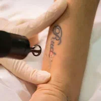 بلفاروپلاستی، پاک کردن تتو، ژل لب، وایتنینگ پوست|خدمات آرایشگری و زیبایی|باقرشهر, |دیوار
