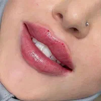 جشنواره تخفیفات ویژه لیزر موهای زائد محمدشهر|خدمات آرایشگری و زیبایی|محمدشهر, محمدشهر|دیوار