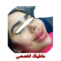 تزریق چربی. .مادلینگ .شکم .پهلو درکلینیک تخصصی|خدمات آرایشگری و زیبایی|کرمانشاه, |دیوار