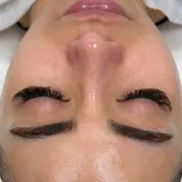 ( تخفیف ویژه فیشال ، پاکسازی پوست)