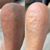 انجام کلیه خدمات پدیکور پا و ناخن با بهترین متریال