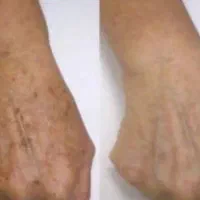 دستتو خوشگل کن