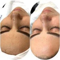 فشیال تخصصی و پاکسازی پوست در محیطی لوکس و آرام -|خدمات آرایشگری و زیبایی|قم, زنبیل آباد|دیوار