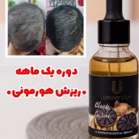 درمان قطعی ریزش مو وموخوره|آرایشی، بهداشتی، درمانی|سراوان, |دیوار