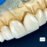 آموزش پودر (پرسلن)گذاری لیرینگ