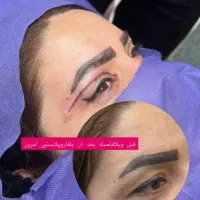 مطب زیبایی لیزر بوتاکس ژل مزو نخ لک جوش