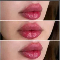 مدل ژل لب رایگان و صورت