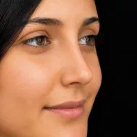 جراحی زیبایی بینی با پیزوسرجری - با اقساط متنوع|خدمات زیبایی و سلامت|تهران, اقدسیه|دیوار