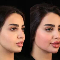 جراحی زیبایی و تزریق ژل و بوتاکس